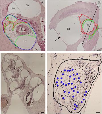 Immune Response After Cochlear Implantation